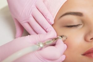Diamant microdermabrasie behandeling